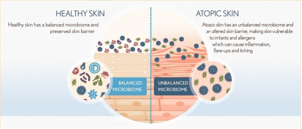 Microbiome Balancing Treatment