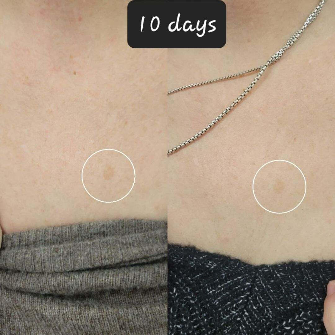 Rapid 7 Dark Spot Corrector