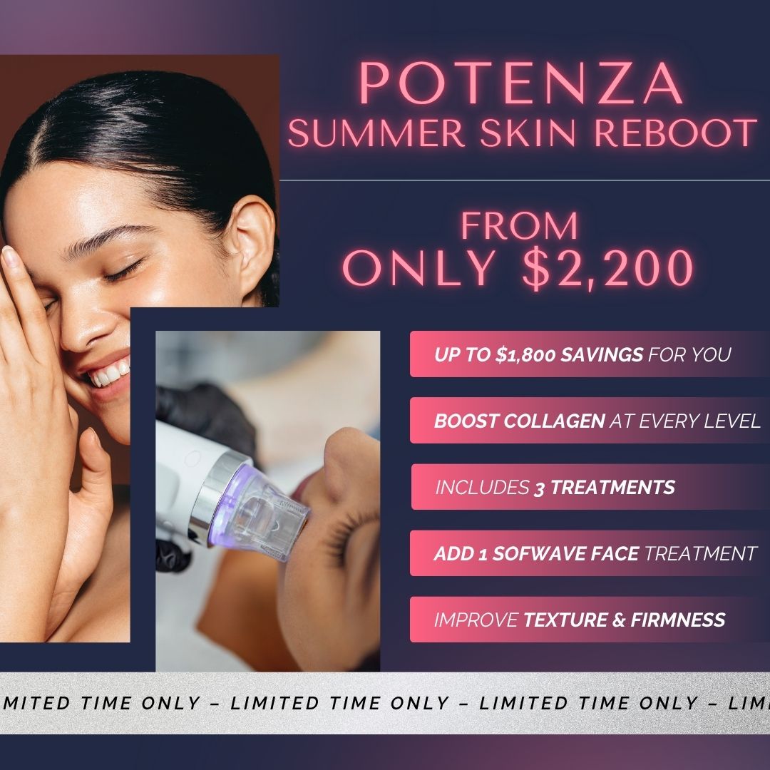 Potenza® RF Microneedling | Series of 3 Treatmes + 1 Sofwave Face Treatment