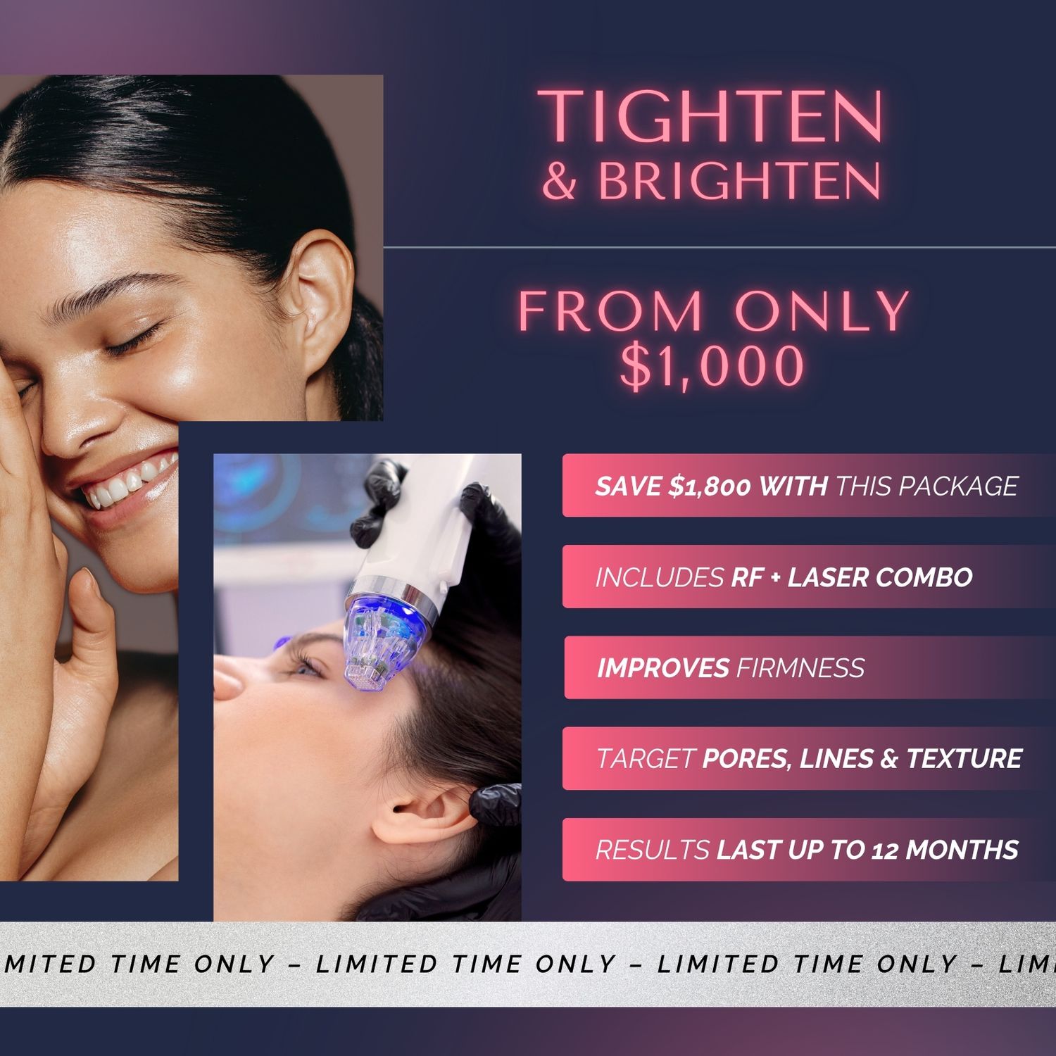 Tighten &amp; Brighten | Potenza RF and Clear + Brilliant Face Treatments