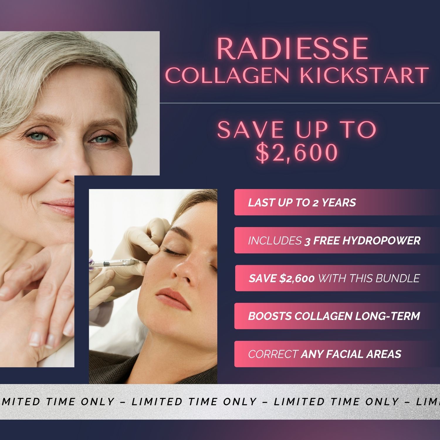 Radiesse Collagen Kickstart | SAVE up to $2,600