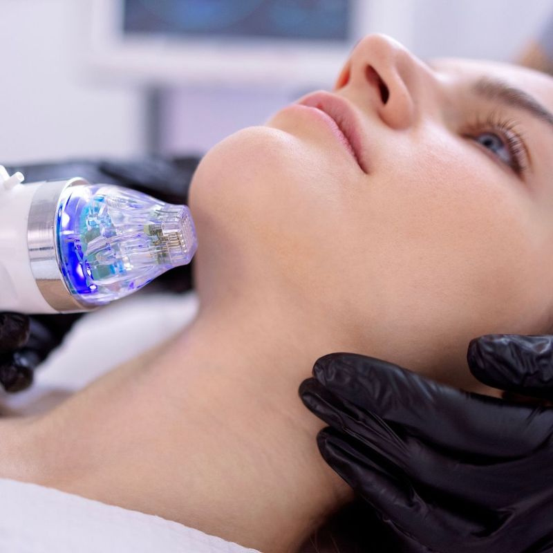 Skin Tightening