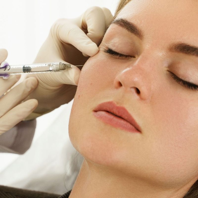 Dermal Fillers