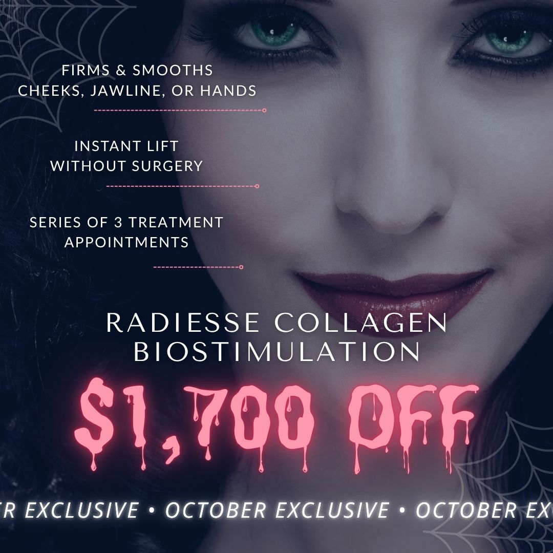 Radiesse Collagen Biostimulation Series | 6 Syringes of Radiesse