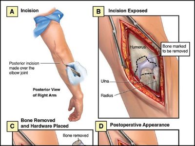 Surgical Illustration