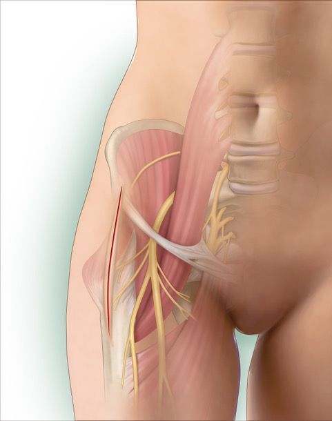 Normal/healthy anatomy of the hip