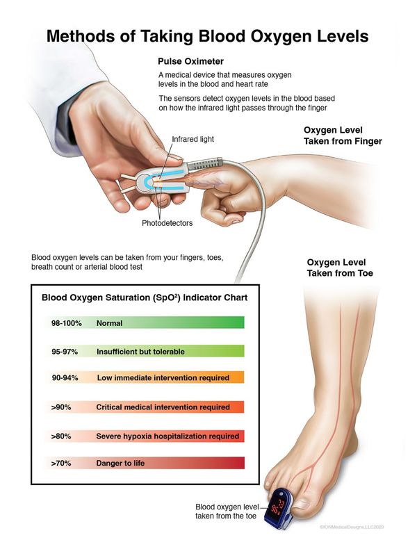 ​Methods of Taking Blood Oxygen Levels