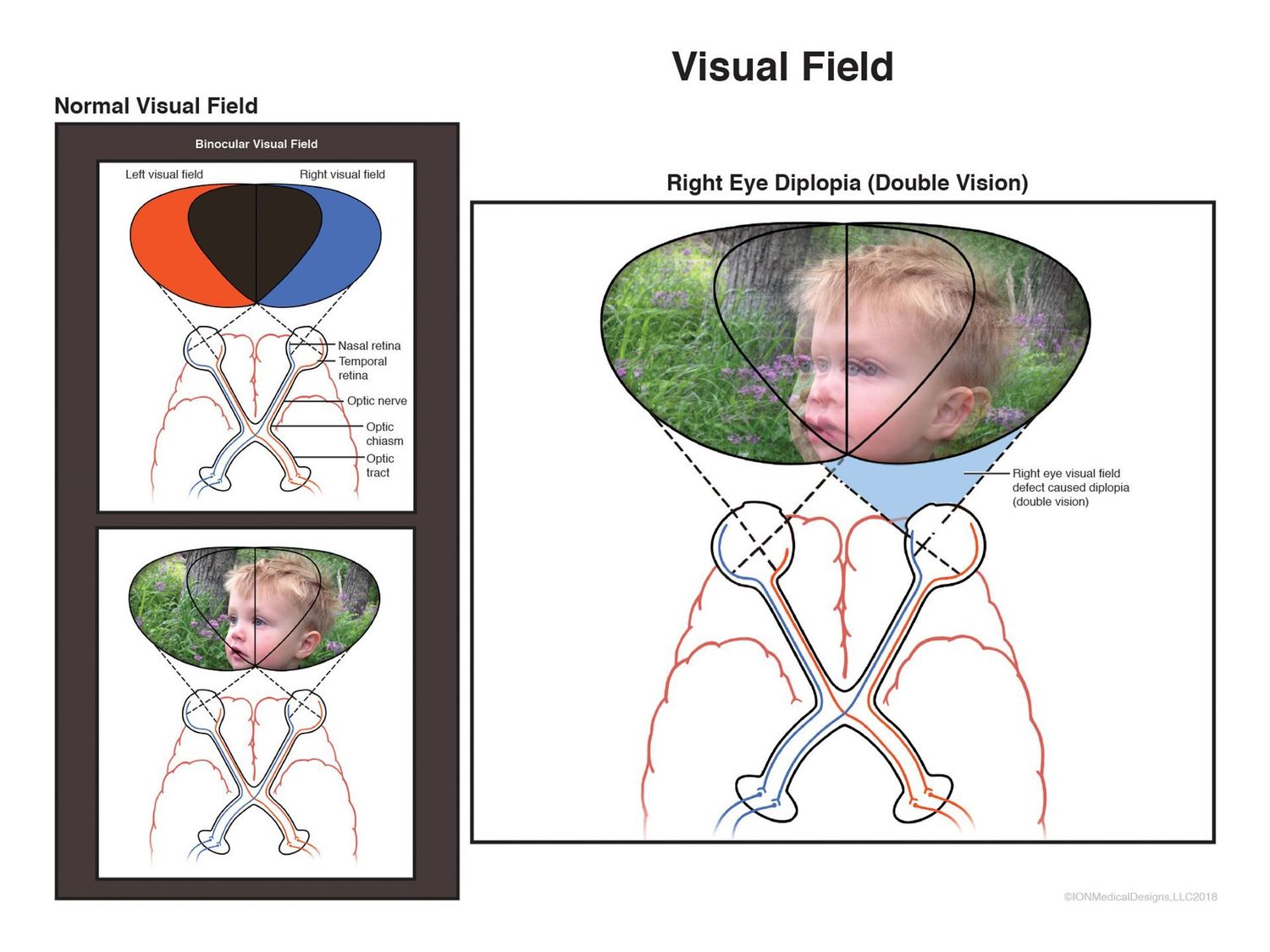 Visual Field