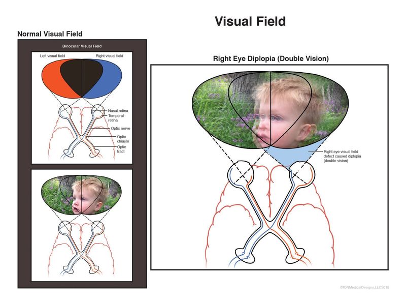 Visual Field