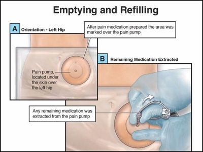 Procedures