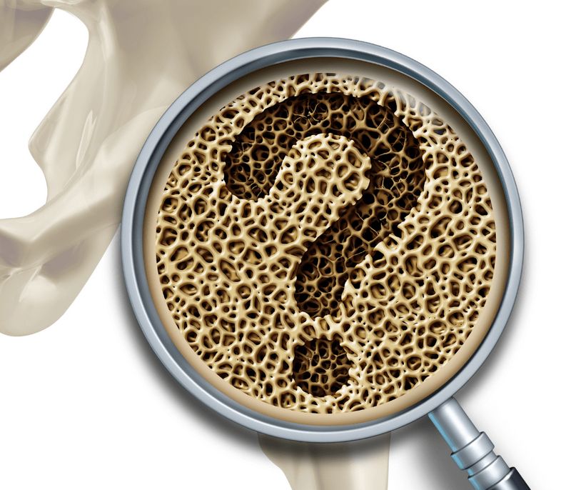 CHECK UP OSTEOPOROSI
