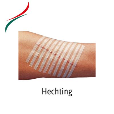 Hechting algemeen