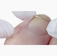 Nageltechnieken - Speciale technieken