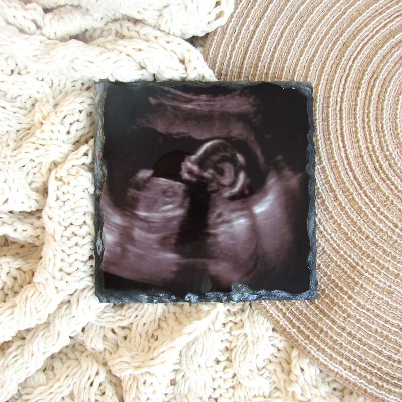 Scan Photo Slate