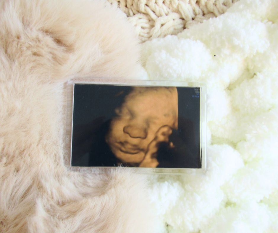 Scan Photo Fridge Magnet