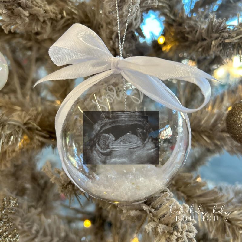 Christmas Bauble - Pregnancy Scan Photo