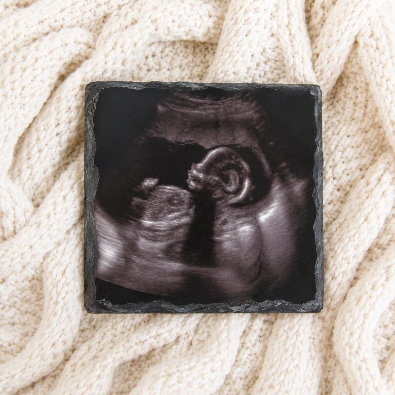 Scan Photo Slate