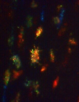 Lucy Osteocytes