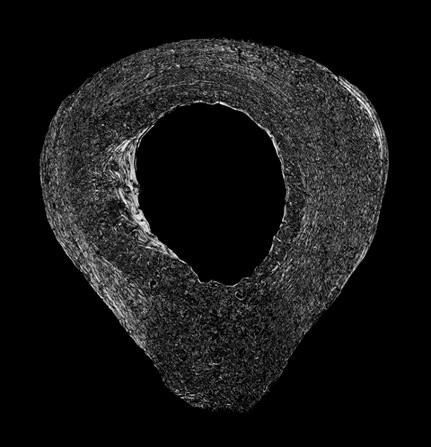 Human Femur Polarized