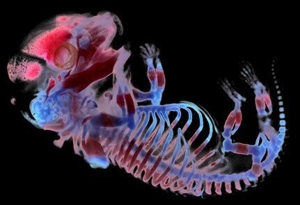 Embryo