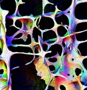 Human Trabecular Bone 1 & 2