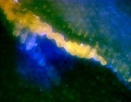 Human Enamel Crack