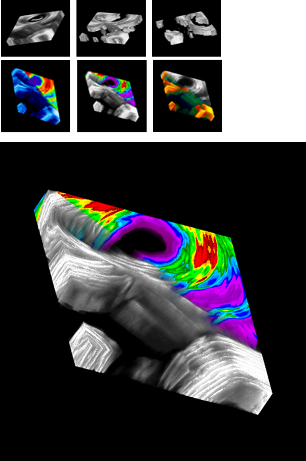 3D Bone Structure