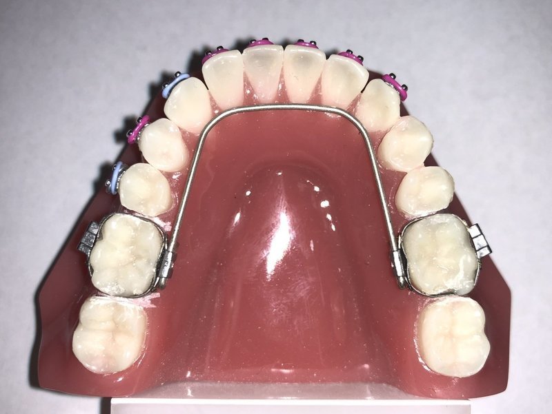 Size 5 FRLA (5 pack)