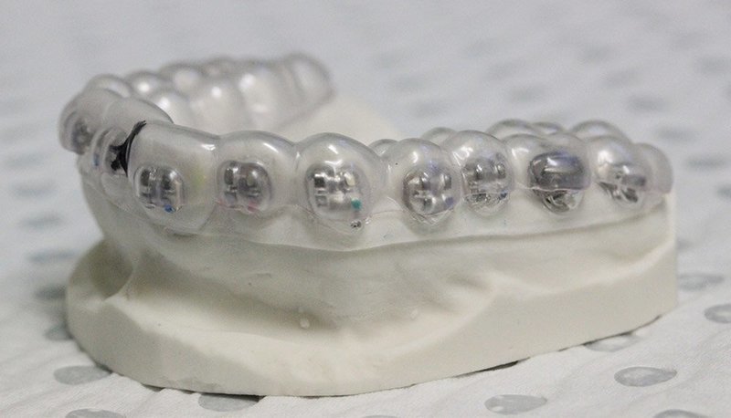 Indirect Bonding Tray  25/pkg