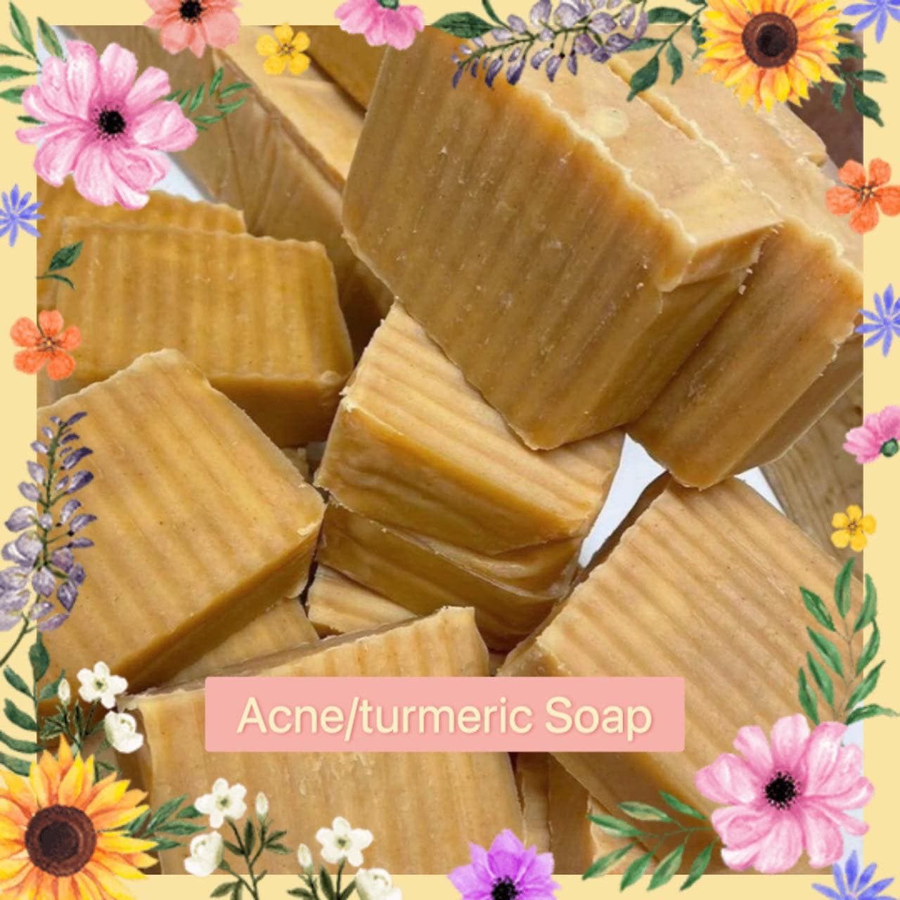 Acne/Turmeric Soap