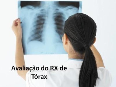 Curso de avaliação do RX de tórax - Ead