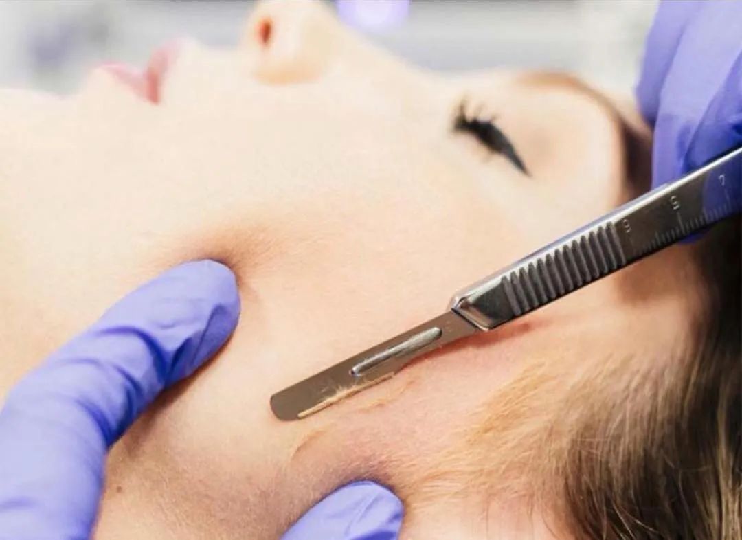 DERMAPLANING CURSUS INSCHRIJVING Theorie + praktijk 15/04 9u30
