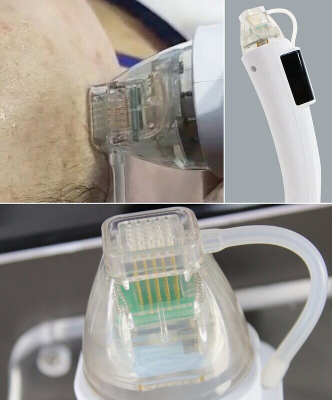 Dermaforce Offer