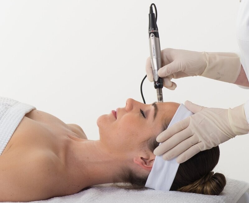 Dermapen New Year Offer