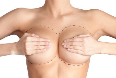 Plastische Chirurgie