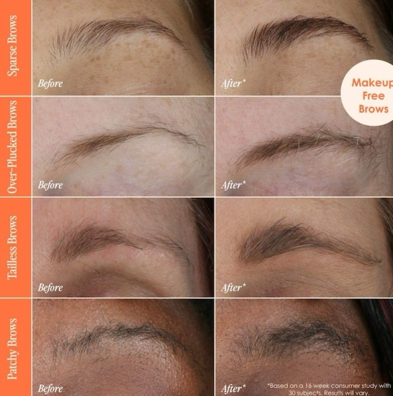 Grande Cosmetics - GrandeBROW Brow Enhancing Serum | 4 Month Supply