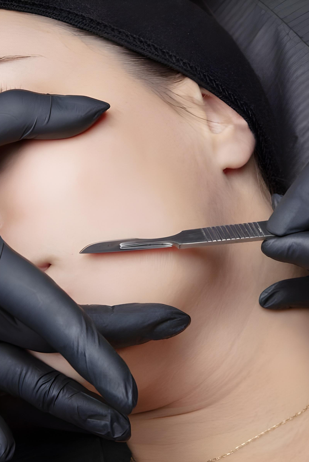 Dermaplaning Course (Online Training)