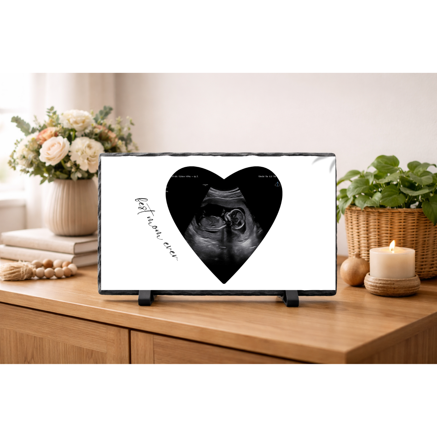 LEISTEEN 2 (upload 1 foto)