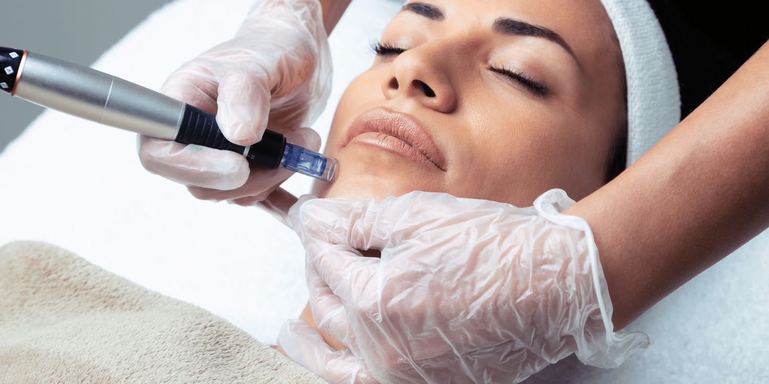 MICRO NEEDLING  Starting at $230.00