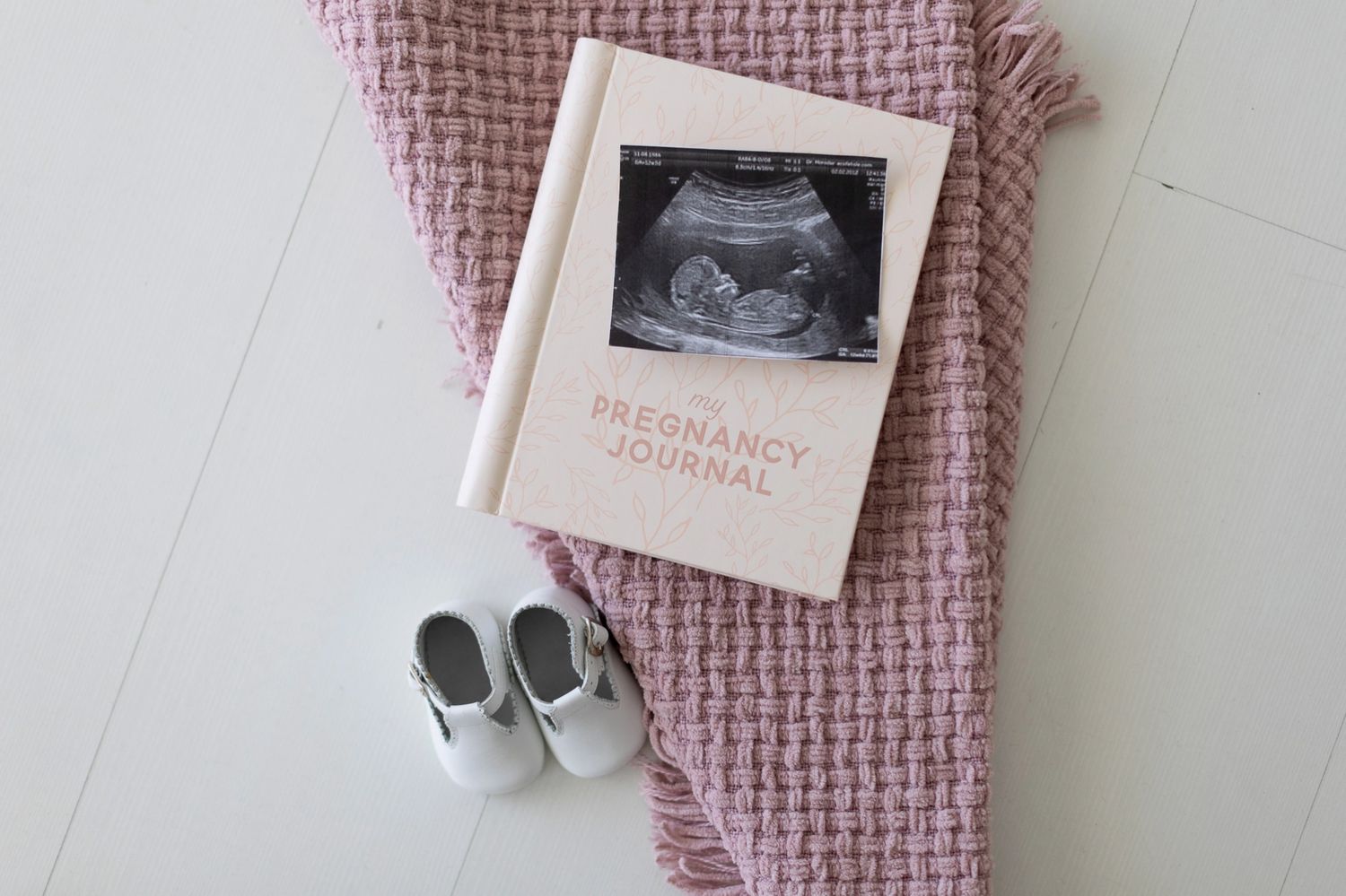 My Pregnancy Keepsake Journal