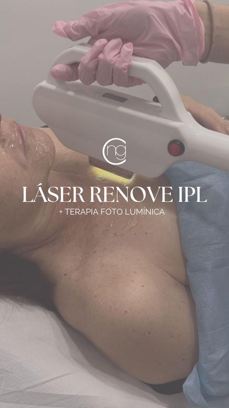 Láser Renove IPL + Terapia fotolumínica