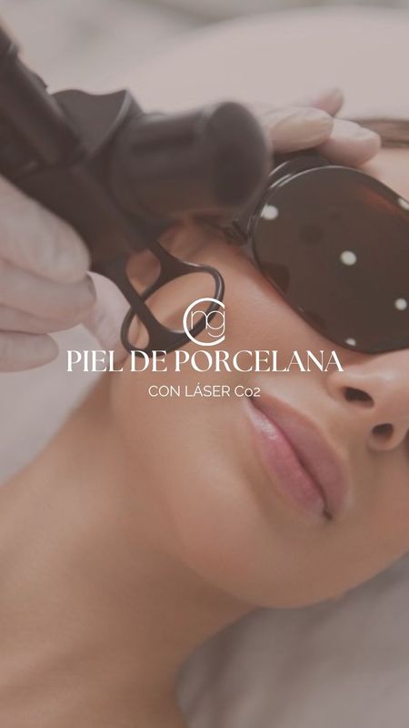 Piel de porcelana con C02: resurfacing facial completo Piel de porcelana con C02: resurfacing facial completo