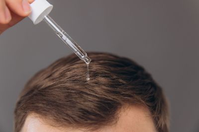 Hair Loss