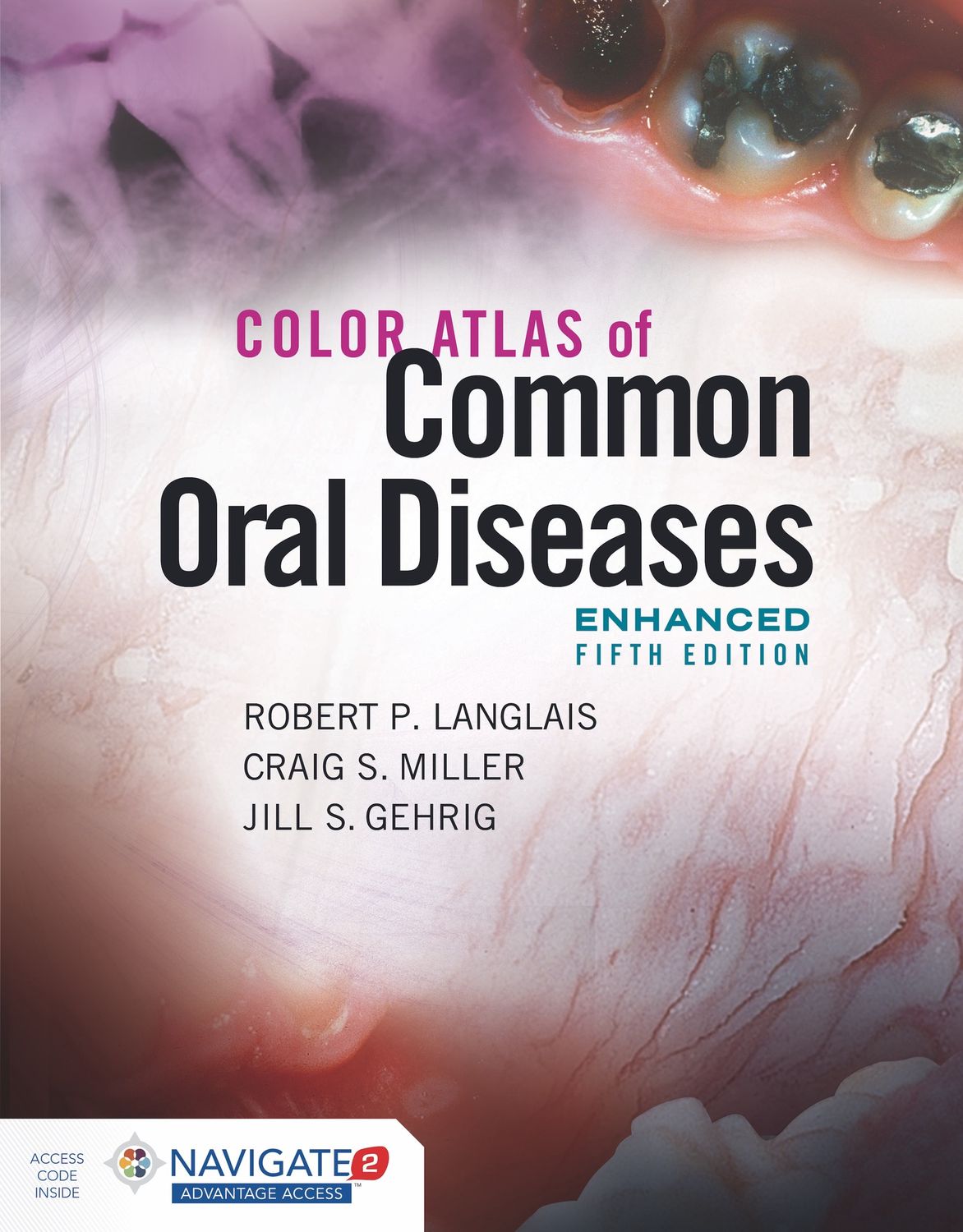 Color Atlas of Common Oral Diseases, Enhanced Edition 5th