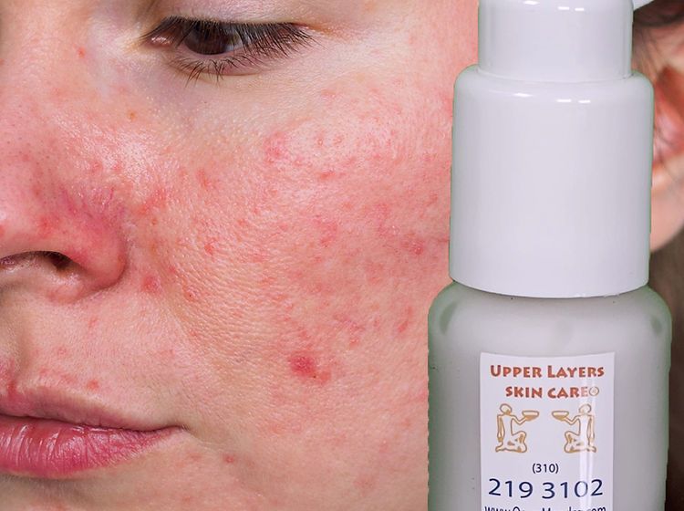 Calming Serum