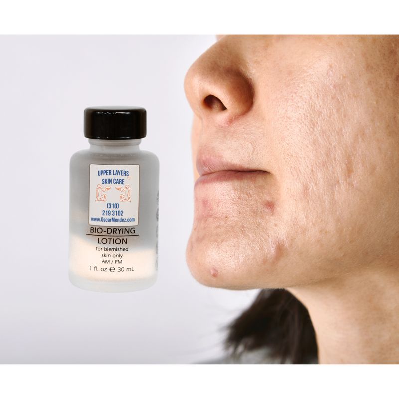 Bio Drying Lotion