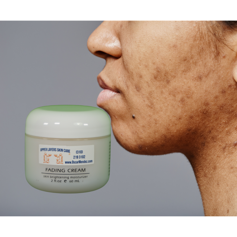 Fading Cream