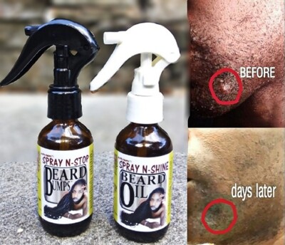 Stop Beard Bumps &
Beard Shine Oil Set