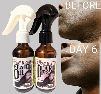 Stop Beard Bumps &amp; Beard Shine Oil Set