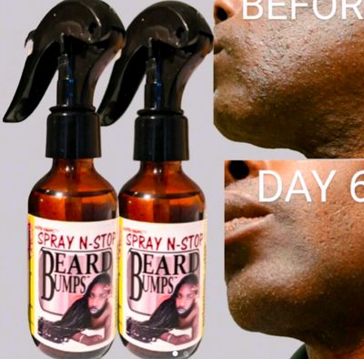 2 PACK SPRAY N-STOP BEARD BUMPS: